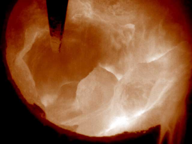 鋅回收用氧化鋅回轉窯結塊監控